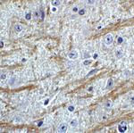 PRDM16 Antibody in Immunohistochemistry (IHC)