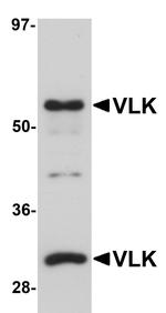 VLK Antibody in Western Blot (WB)