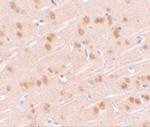 SYNGR1 Antibody in Immunohistochemistry (IHC)