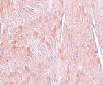 REEP3 Antibody in Immunohistochemistry (IHC)