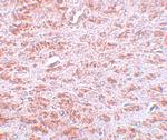 CDX2 Antibody in Immunohistochemistry (IHC)