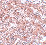 LIN28A Antibody in Immunohistochemistry (IHC)