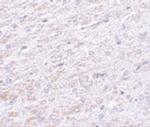 TCF3 Antibody in Immunohistochemistry (IHC)