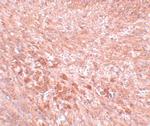 LZTR2 Antibody in Immunohistochemistry (IHC)