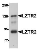 LZTR2 Antibody in Western Blot (WB)