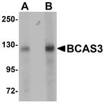 BCAS3 Antibody in Western Blot (WB)