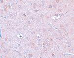 DCLK1 Antibody in Immunohistochemistry (IHC)