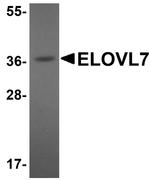 ELOVL7 Antibody in Western Blot (WB)