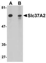 SLC37A2 Antibody in Western Blot (WB)