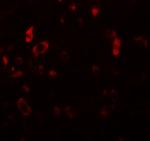 PIAS2 Antibody in Immunohistochemistry (IHC)