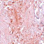 PIAS3 Antibody in Immunohistochemistry (IHC)