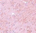 PIASy Antibody in Immunohistochemistry (IHC)