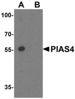 PIASy Antibody in Western Blot (WB)