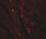 IDH2 Antibody in Immunohistochemistry (IHC)