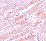 IDH2 Antibody in Immunohistochemistry (IHC)