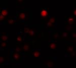 ZEB1 Antibody in Immunocytochemistry (ICC/IF)