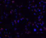 ZEB2 Antibody in Immunocytochemistry (ICC/IF)