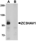 ZC3HAV1 Antibody in Western Blot (WB)