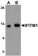 IFITM1 Antibody in Western Blot (WB)