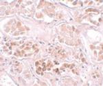 SCRN1 Antibody in Immunohistochemistry (IHC)