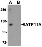 ATP11A Antibody in Western Blot (WB)