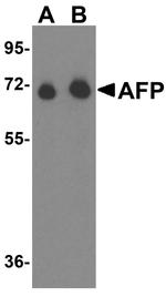 AFP Antibody in Western Blot (WB)