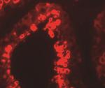 YBX2 Antibody in Immunohistochemistry (IHC)