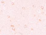 CIITA Antibody in Immunohistochemistry (IHC)