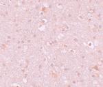 CXXC4 Antibody in Immunohistochemistry (IHC)