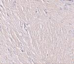 SYNPO Antibody in Immunohistochemistry (IHC)