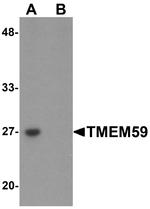 TMEM59 Antibody in Western Blot (WB)