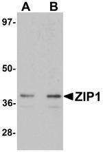 ZIP1 Antibody in Western Blot (WB)