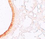 SLC39A3 Antibody in Immunohistochemistry (IHC)