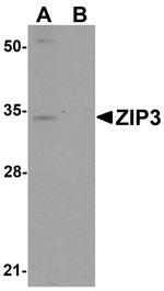 SLC39A3 Antibody in Western Blot (WB)