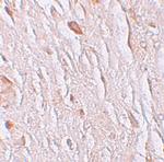 SLC39A7 Antibody in Immunohistochemistry (Paraffin) (IHC (P))