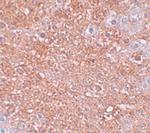 ZIP12 Antibody in Immunohistochemistry (IHC)