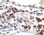 TFF3 Antibody in Immunohistochemistry (IHC)