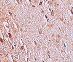 WIZ Antibody in Immunohistochemistry (IHC)