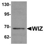 WIZ Antibody in Western Blot (WB)