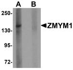 ZMYM1 Antibody in Western Blot (WB)