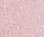 LRRTM2 Antibody in Immunohistochemistry (IHC)