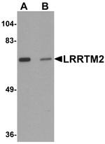 LRRTM2 Antibody in Western Blot (WB)