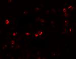 OGFOD1 Antibody in Immunocytochemistry (ICC/IF)