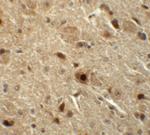 Nkx3.2 Antibody in Immunohistochemistry (IHC)