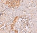 ESRP1 Antibody in Immunohistochemistry (IHC)