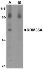 ESRP1 Antibody in Western Blot (WB)