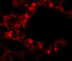 ESRP2 Antibody in Immunohistochemistry (IHC)