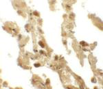 ESRP2 Antibody in Immunohistochemistry (IHC)