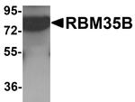 ESRP2 Antibody in Western Blot (WB)