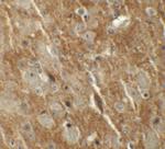 CTNNBL1 Antibody in Immunohistochemistry (IHC)